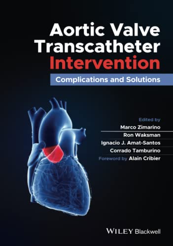 Aortic Valve Transcatheter Intervention: Complications and Solutions von Wiley-Blackwell